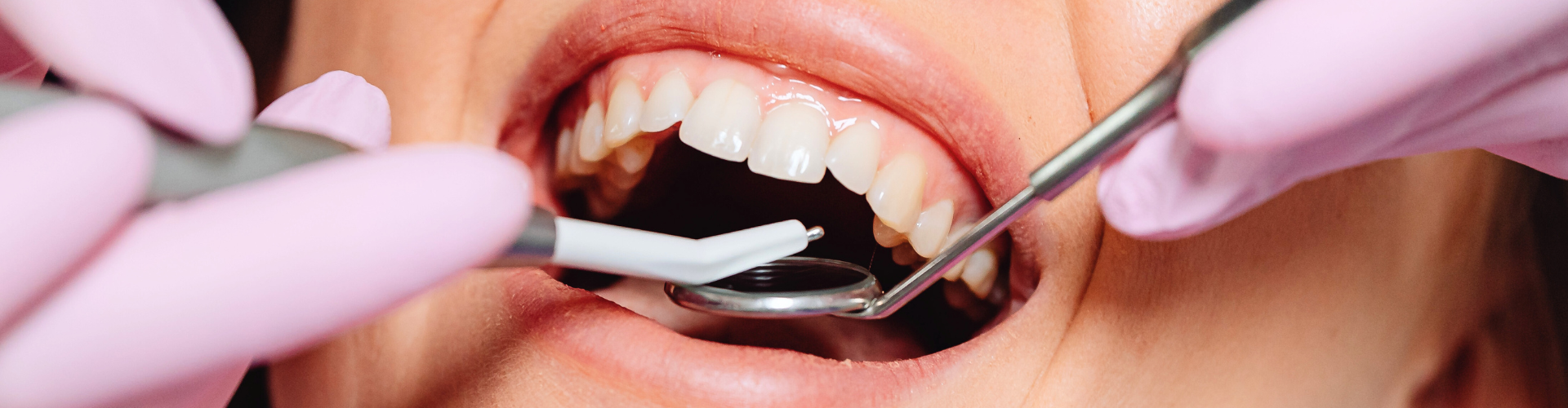 Gloved hands using dental tools in woman's mouth,